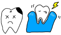 虫歯　歯周病　口臭原因